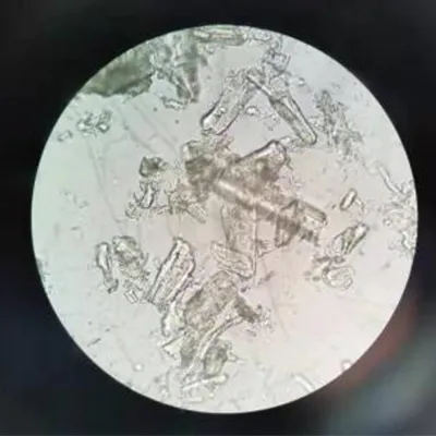 Before homogenization